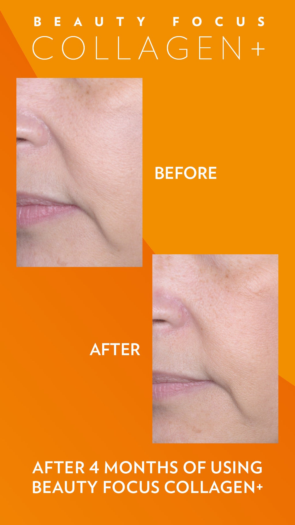 Beauty Focus Collagen+