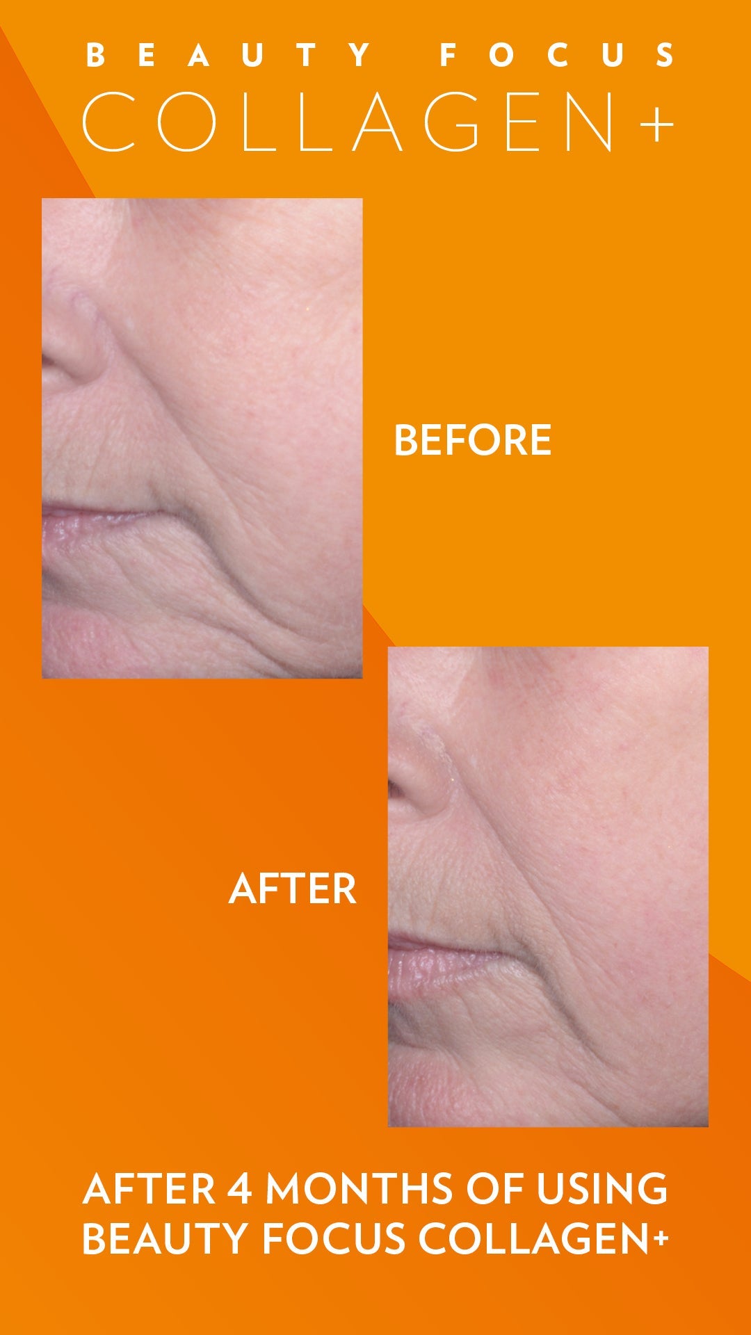 Beauty Focus Collagen+